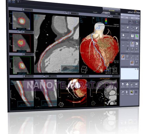 cardiology pacs